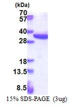 Human RPS4X Protein (Recombinant His)