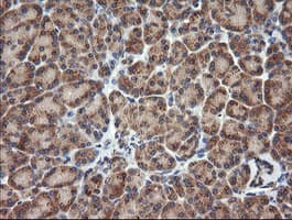 TCL / RHOJ Antibody (clone OTI2C9)