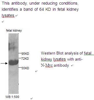Polyclonal Rabbit anti-Human MYCN / N-myc Antibody (WB)