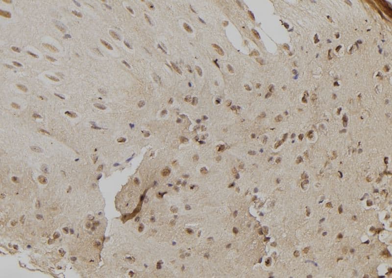 CHD8 Antibody