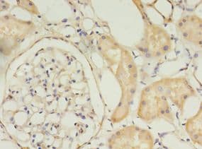 TIMM10 Antibody (aa1-90)