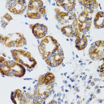 RIP4 / ANKRD3 Antibody