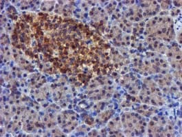 FGFR2 / FGF Receptor 2 Antibody (clone OTI3F8)