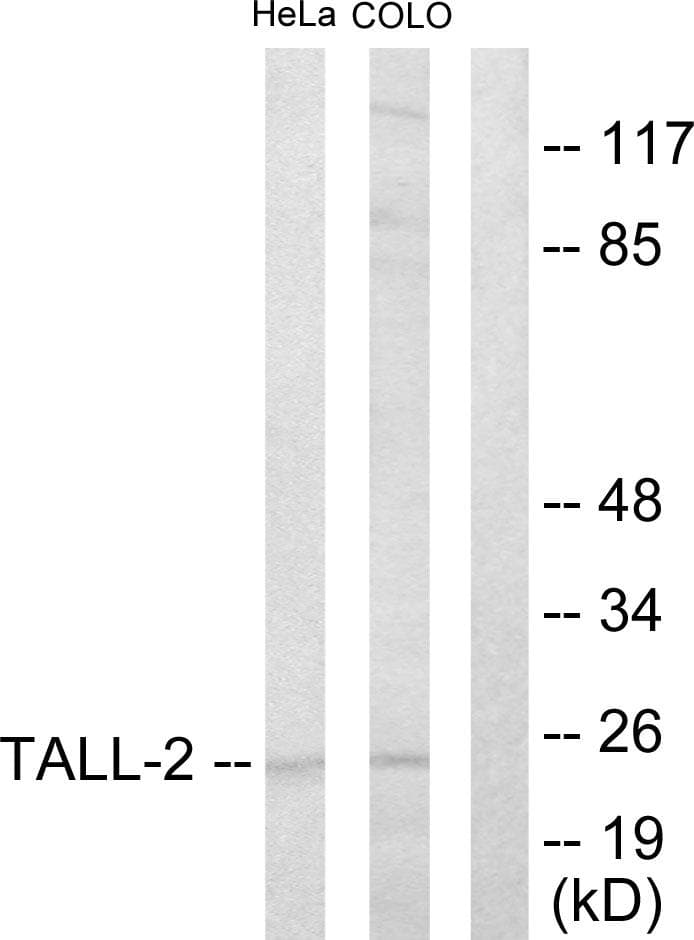 Polyclonal Rabbit anti-Human TNFSF13 / APRIL Antibody (IHC, IF, WB)