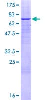 Human ABHD12 Protein (Recombinant GST)