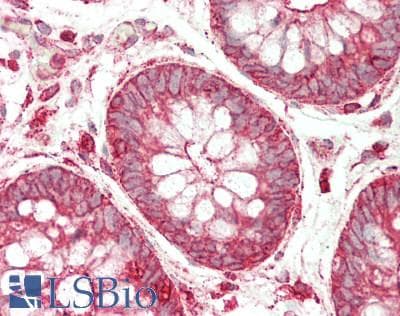 IHC-plus™ NF2 / Merlin Antibody (aa550-C-term)