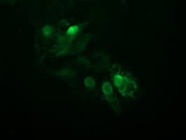 UBE2S / E2 EPF Antibody (clone OTI4H3)