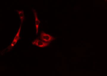 CDCA3 Antibody