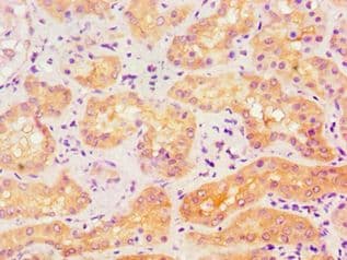 ACTR3B / ARP4 Antibody (aa189-418)