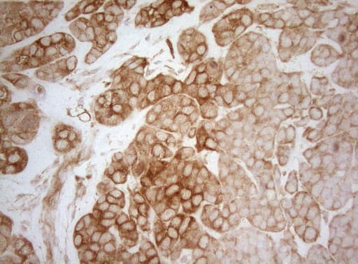 AHSA1 / AHA1 Antibody (aa1-203, clone OTI1D2)