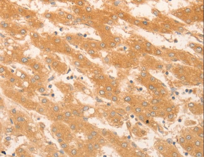 Polyclonal Rabbit anti-Human NAP1L1 Antibody (IHC, WB)