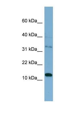 PHLDA2 / TSSC3 Antibody (C-Terminus)