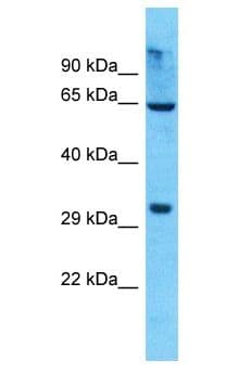 Polyclonal Rabbit anti-Human OR8K5 Antibody (aa258-307, WB)