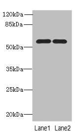 PSMD12 / Rpn5 Antibody