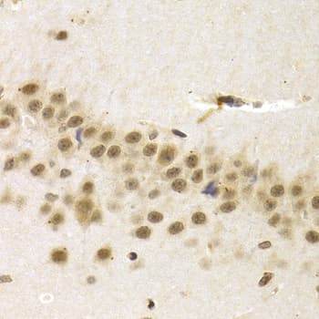 UMPS / OPRT Antibody