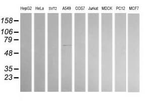 ALDH1A3 Antibody (clone OTI4B4)