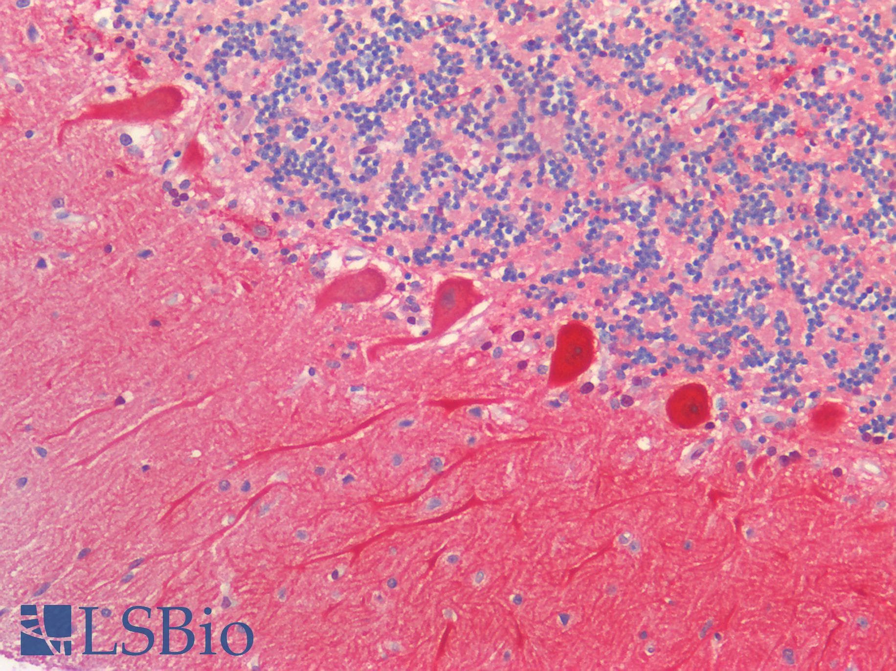IHC-plus™ CALB1 / Calbindin Antibody