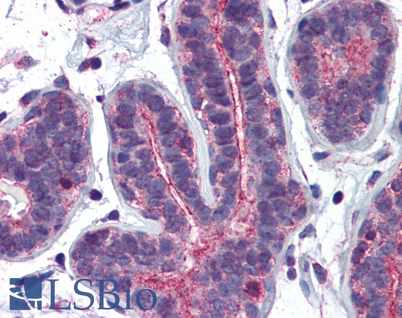 IHC-plus™ Monoclonal Mouse anti-Human RHOA Antibody (clone 1B12, IHC, IF, WB)