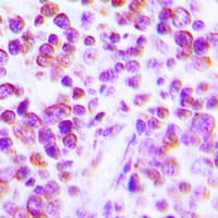 TNF Alpha Antibody (Internal)