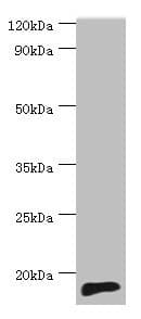 IHC-plus™ Polyclonal Rabbit anti-Human TNNC2 Antibody (aa1-160, IHC, WB)