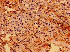 ARA55 / HIC-5 Antibody
