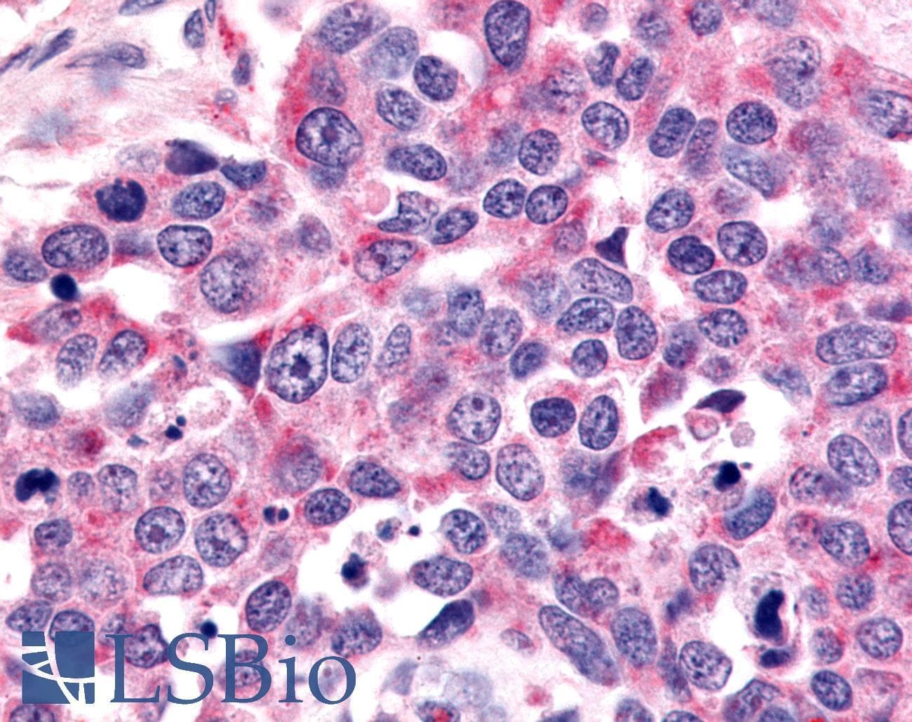 PathPlus™ OR6K3 Antibody (N-Terminus)