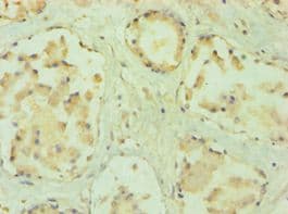 PPP3CC / CALNA3 Antibody (aa373-512)