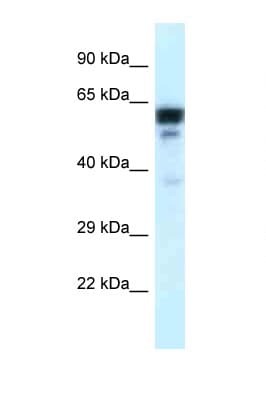 Polyclonal Rabbit anti-Human TUBA1C / Tubulin Alpha 1C Antibody (C-Terminus, WB)