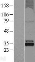 OXNAD1 Protein (Over-Expression Lysate Myc-DDK (Flag))