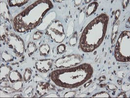 Monoclonal Mouse anti-Human SKIL / SNO / SnoN Antibody (clone OTI3E2, IHC, WB)