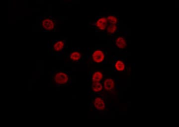 Polyclonal Rabbit anti-Human CDKN1C / p57 Kip2 Antibody (phospho-Thr310, IF, WB)