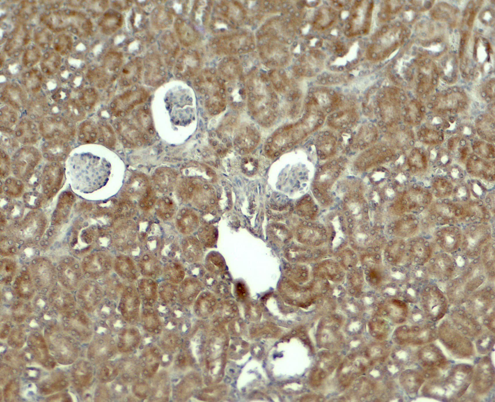 Polyclonal Rabbit anti-Human RHOG / ARHG Antibody (IHC, WB)