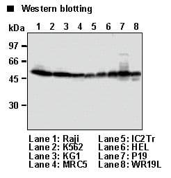 Monoclonal Mouse anti-Human TXNIP Antibody (clone JY2, WB)