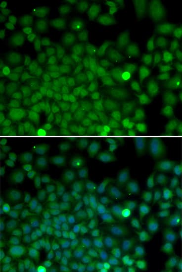 Polyclonal Rabbit anti-Human SNAI2 / SLUG Antibody (IHC, IF, WB)