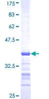 Human SH3RF2 Protein (Recombinant GST, N-terminus)