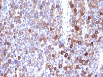 MSN / Moesin Antibody (clone MSN/491)