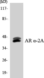 Polyclonal Rabbit anti-Human ADRA2A Antibody (aa312-361, IHC, WB)