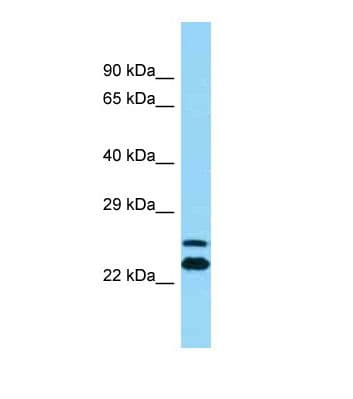 ARFIP2 / Arfaptin 2 Antibody (aa21-70)