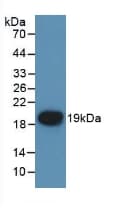 F7 / Factor VII Antibody (aa42-169)