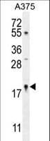 SNRNP27 Antibody (aa69-98)