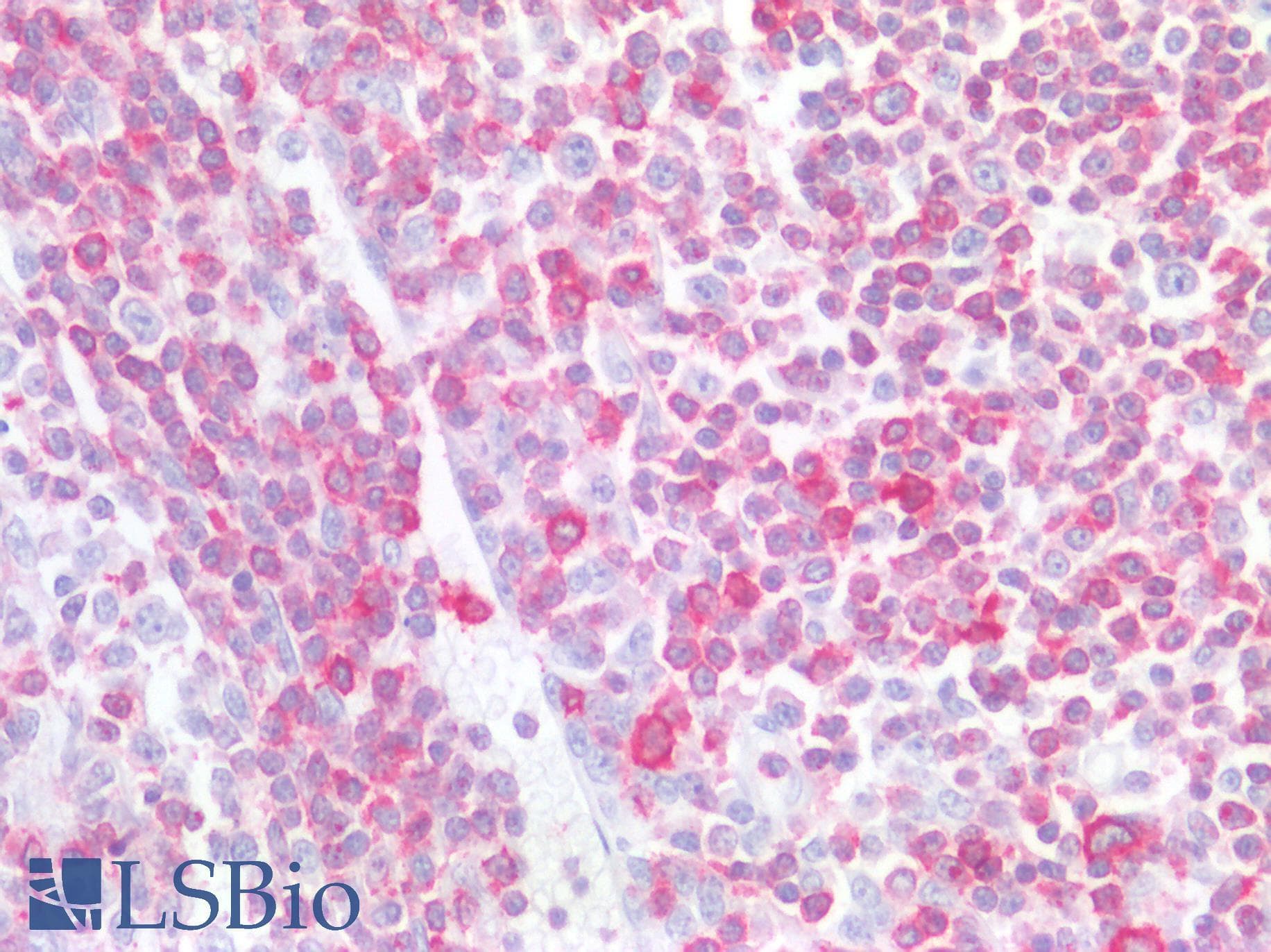 PathPlus™ LSP1 Antibody (aa37-48)