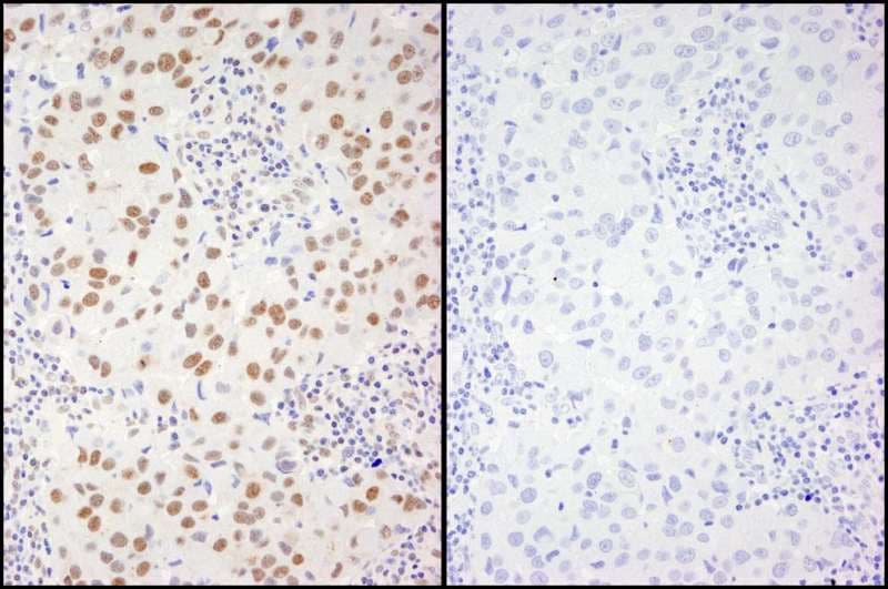 Polyclonal Rabbit anti-Human XRCC1 Antibody (phospho-Ser461, IHC)