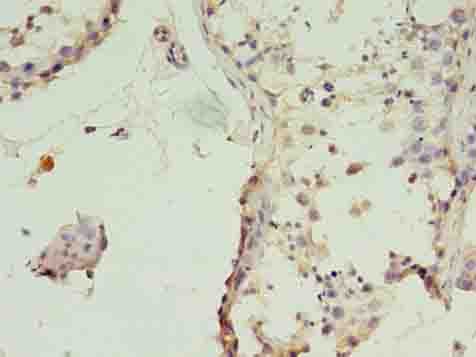 TIMM10B / FXC1 Antibody