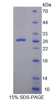 Mouse LPXN / Leupaxin Protein (Recombinant His-T7)