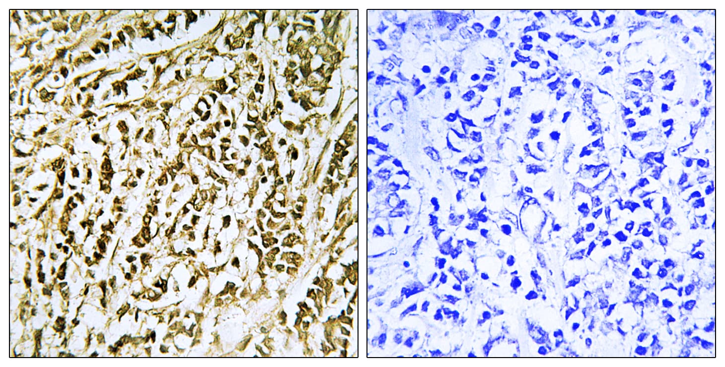 FEN1 Antibody (aa86-135)