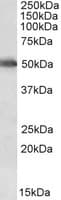 IHC-plus™ Polyclonal Goat anti-Human CYP2E1 Antibody (aa233-243, IHC, WB)