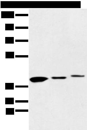 MAT2B Antibody