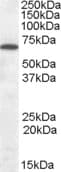 Polyclonal Goat anti-Human CNR1 / CB1 Antibody (aa320-334, WB)