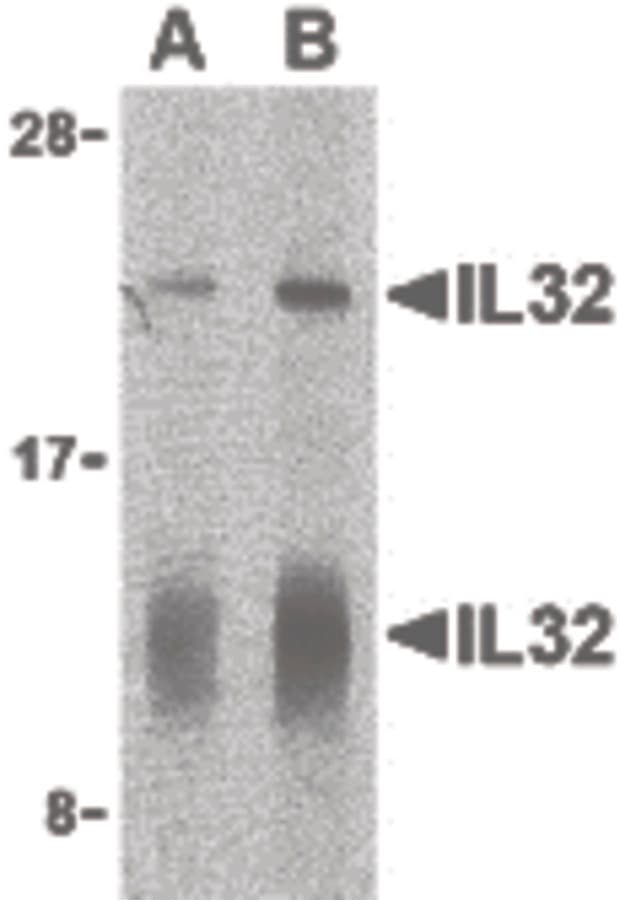 IHC-plus™ IL32 Antibody
