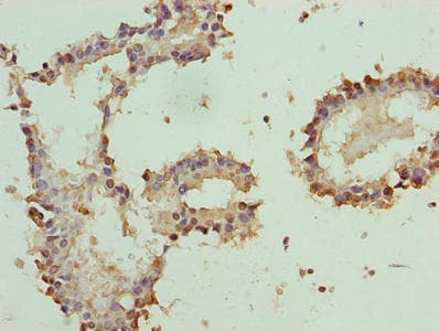 PLP1 / Myelin PLP Antibody (aa143-197)